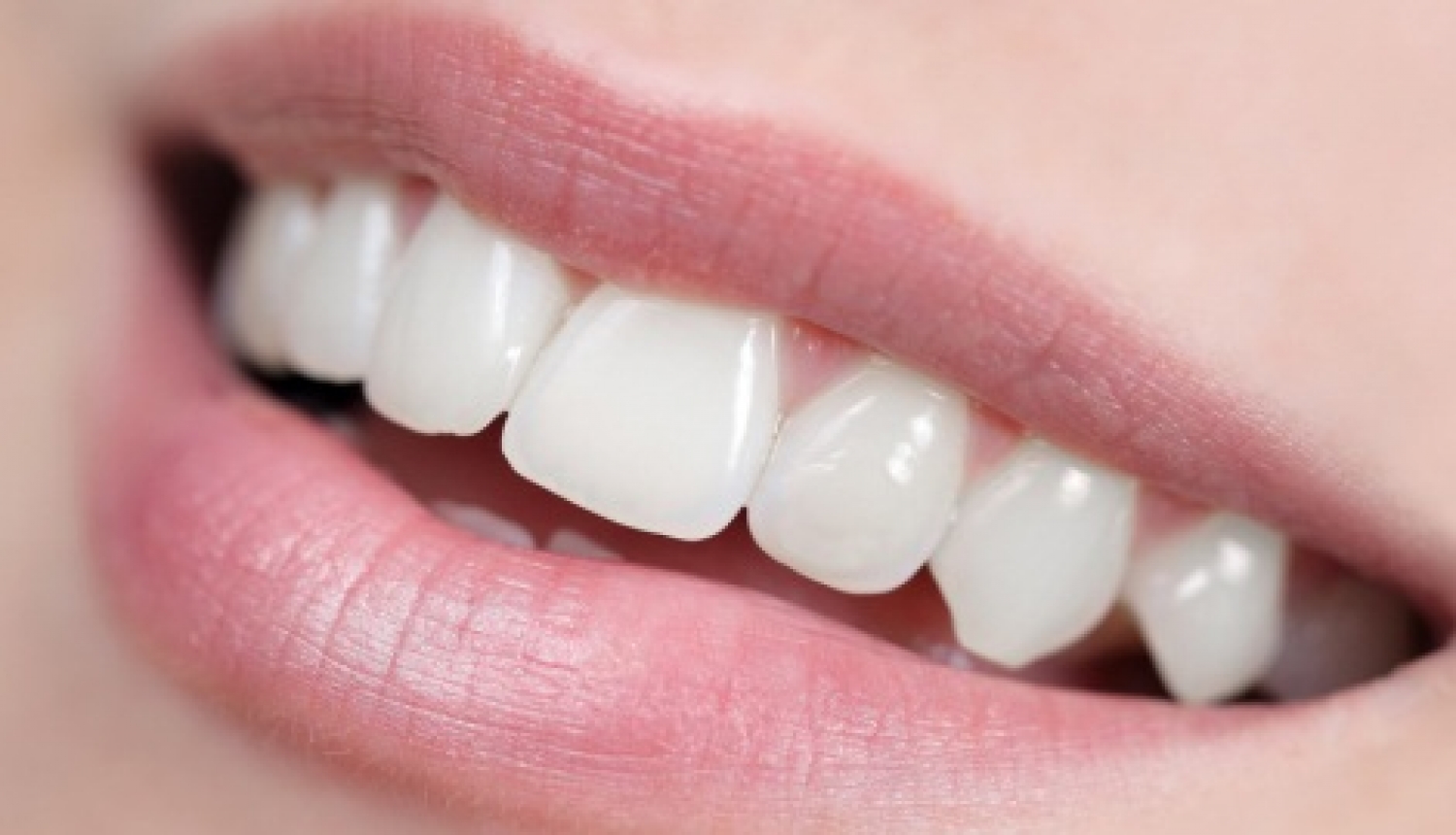 Comment avoir les dents blanches